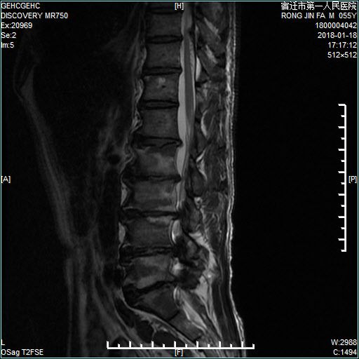 伏龙诀 视频缩略图